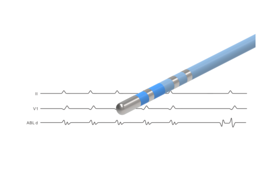 NAVABLATOR? 心臟<font color=red>射頻消融</font>導管