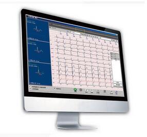 動態心電圖分析系統Cardio 8000 