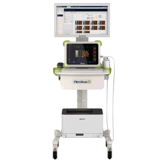 回波肝臟瞬時彈性檢測儀fibroscan Q