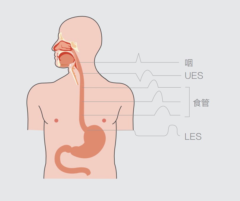 吞咽神經(jīng)肌肉低頻電刺激儀