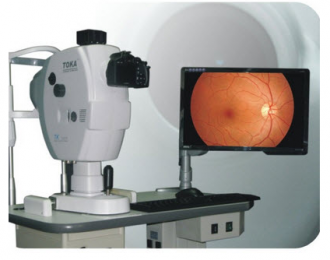  眼底照相機：深入探索眼底健康的進工具