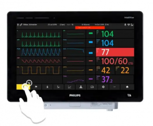 飛利浦心電監(jiān)護儀的價格與性能