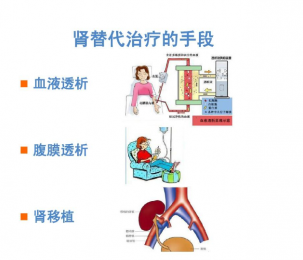 血液透析設備的價格及選購指南 