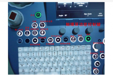 超聲儀器按鍵功能解析|朗逸醫療
