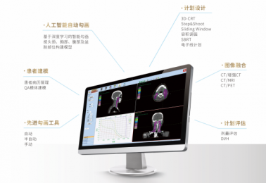 三維放射治療計(jì)劃系統(tǒng)的原理|特點(diǎn)解析