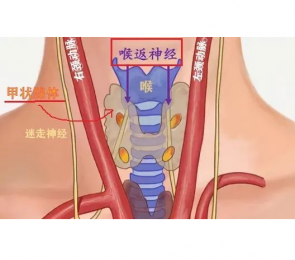 喉返神經監測儀品牌|使用方法|注意事項