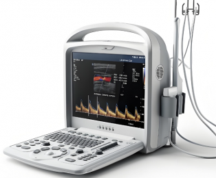 飛依諾便攜式彩超V6功能介紹-朗逸器械醫療