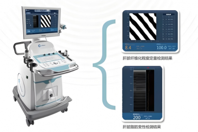 超聲瞬時(shí)彈性成像優(yōu)缺點(diǎn)|超聲瞬時(shí)彈性成像特點(diǎn)