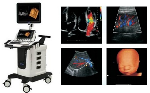 時邁全數(shù)字彩色多普勒超聲診斷系統(tǒng)S70