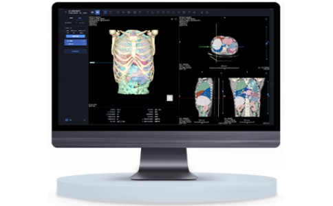 海杰亞HYVISION?肝臟CT圖像處理軟件3DVisualization