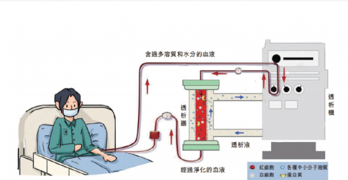 了解血液透析機的工作原理、裝置特點及應用