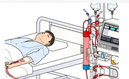 了解血液透析機(jī)器的工作原理、外觀和結(jié)構(gòu)