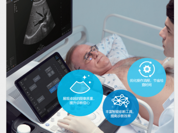 智能超聲診斷系統 RS7-朗逸醫療
