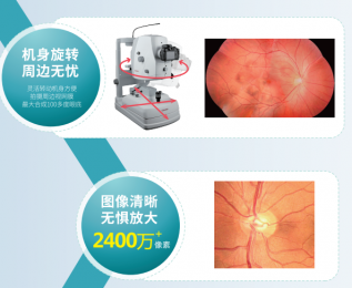 TNF506 數(shù)碼眼底照相機-高清影像質(zhì)量的專業(yè)醫(yī)療設(shè)備